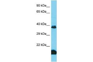 Host: Rabbit Target Name: TAS2R3 Sample Type: Fetal Kidney lysates Antibody Dilution: 1.