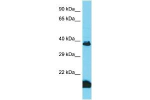 Host: Rabbit Target Name: TAS2R3 Sample Type: Fetal Kidney lysates Antibody Dilution: 1. (TAS2R3 antibody  (Middle Region))