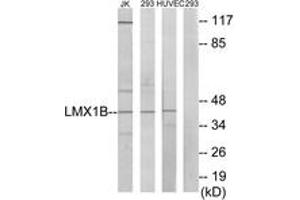 Western blot analysis of extracts from Jurkat/293/HuvEc cells, using LMX1B Antibody. (LMX1B antibody  (AA 126-175))