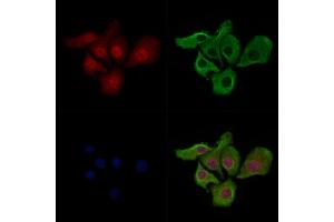 ABIN7093232 and ABIN7097244 staining Hela cells(heat shock treatment) by IF/ICC. (p53 antibody  (acLys386))