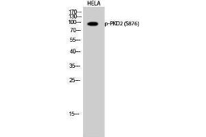 Western Blotting (WB) image for anti-Polycystic Kidney Disease 2 (Autosomal Dominant) (PKD2) (pSer876) antibody (ABIN3182238)