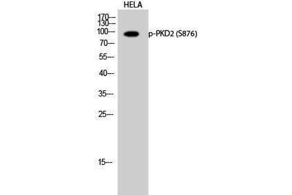 PKD2 antibody  (pSer876)