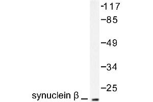 Image no. 1 for anti-Synuclein, beta (SNCB) antibody (ABIN271836) (beta Synuclein antibody)