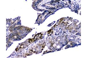IHC analysis of Cytochrome C using anti-Cytochrome C antibody (ABIN5693008). (Cytochrome C antibody  (AA 2-105))