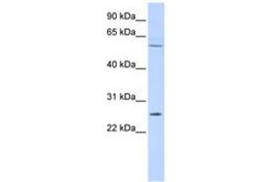 Image no. 1 for anti-Family with Sequence Similarity 124A (FAM124A) (AA 504-553) antibody (ABIN6741329) (FAM124A antibody  (AA 504-553))