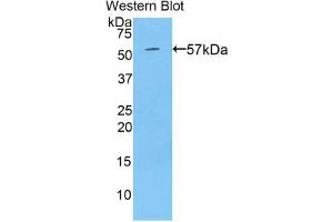 Detection of Recombinant TGM1, Human using Polyclonal Antibody to Transglutaminase 1 (TGM1) (TGM1 antibody  (AA 496-760))