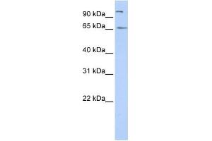 SPATA16 antibody used at 1 ug/ml to detect target protein. (SPATA16 antibody  (N-Term))