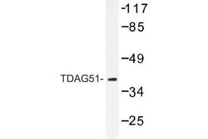 Image no. 1 for anti-Pleckstrin Homology-Like Domain, Family A, Member 1 (PHLDA1) antibody (ABIN317621) (PHLDA1 antibody)