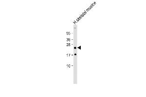 Anti-HOXA7 Antibody (Center) at 1:2000 dilution + Human skeletal muslce lysate Lysates/proteins at 20 μg per lane. (HOXA7 antibody  (AA 82-114))