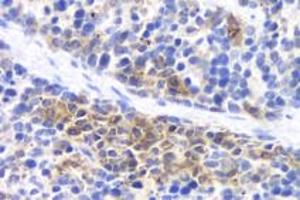 Immunohistochemistry analysis of paraffin-embedded mouse inflammatory spleen using IL-17 (ABIN7074342) at dilution of 1:800