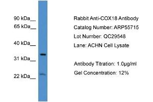 WB Suggested Anti-COX18  Antibody Titration: 0.