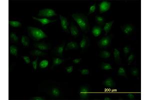 Immunofluorescence of monoclonal antibody to ZIC4 on HeLa cell. (ZIC4 antibody  (AA 249-319))
