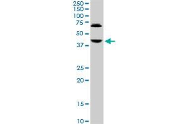 ABHD5 antibody  (AA 1-349)