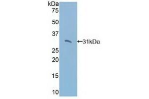 Detection of Recombinant TRADD, Human using Polyclonal Antibody to TNFRSF1A Associated Via Death Domain Protein (TRADD) (TRADD antibody  (AA 61-297))