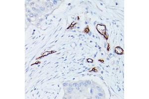 Immunohistochemistry (IHC) image for anti-CD34 (CD34) (C-Term) antibody (ABIN6138169)