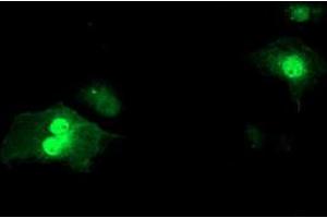 Anti-SDS mouse monoclonal antibody (ABIN2455363) immunofluorescent staining of COS7 cells transiently transfected by pCMV6-ENTRY SDS (RC217814). (serine Dehydratase antibody)