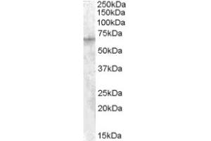 Image no. 1 for anti-Insulin-Like Growth Factor 2 mRNA Binding Protein 2 (IGF2BP2) (C-Term) antibody (ABIN374940) (IGF2BP2 antibody  (C-Term))