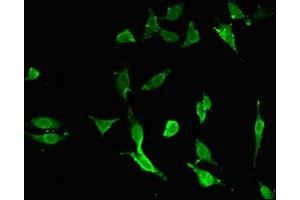 Immunofluorescent analysis of Hela cells using ABIN7173772 at dilution of 1:100 and Alexa Fluor 488-congugated AffiniPure Goat Anti-Rabbit IgG(H+L) (TNFAIP3 antibody  (AA 97-183))