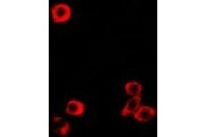 Immunofluorescent analysis of RBP2 staining in MCF7 cells. (RBP2 antibody)