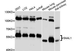 Western blot analysis of extracts of various cell lines, using SAAL1 antibody (ABIN6293922) at 1:3000 dilution.