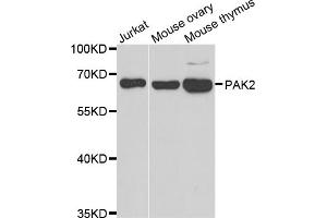 Western blot analysis of extracts of various cell lines, using PAK2 antibody.