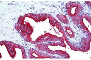 Human Prostate: Formalin-Fixed, Paraffin-Embedded (FFPE) (LAMP2 antibody)