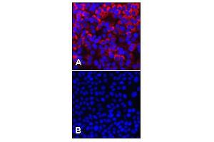 Immunofluorescent detection of HCV NS3. (HCV NS3 antibody)