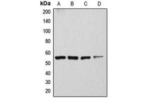 Western blot analysis of ATP6V1H expression in Caki1 (A), SKNSH (B), rat kidney (C), mouse brain (D) whole cell lysates.