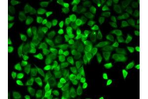 Immunofluorescence analysis of A549 cell using CASP3 antibody. (Caspase 3 antibody  (AA 55-160))