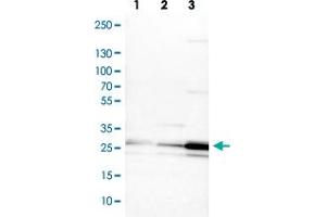 Western blot analysis of Lane 1: NIH-3T3 cell lysate (Mouse embryonic fibroblast cells) Lane 2: NBT-II cell lysate (Rat Wistar bladder tumour cells) Lane 3: PC12 cell lysate (Pheochromocytoma of rat adrenal medulla) with PCMT1 polyclonal antibody  at 1:100-1:500 dilution.