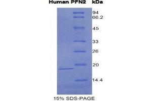 SDS-PAGE (SDS) image for Profilin 2 (PFN2) (AA 5-140) protein (His tag) (ABIN1981176) (PFN2 Protein (AA 5-140) (His tag))
