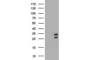 Image no. 4 for anti-CD99 (CD99) antibody (ABIN1497382) (CD99 antibody)