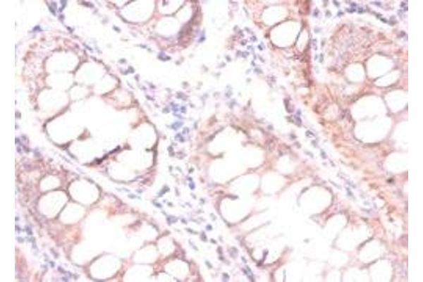 CDKN2AIPNL antibody  (N-Term)