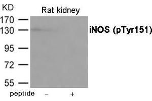 Western blot analysis of extracts from Rat kindey using iNOS (Phospho-Tyr151) Antibody. (NOS2 antibody  (pTyr151))