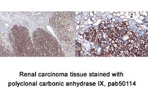 Image no. 1 for anti-Carbonic Anhydrase IX (CA9) (AA 400-500), (C-Term) antibody (ABIN363423) (CA9 antibody  (C-Term))