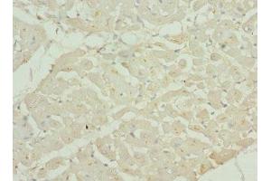 Immunohistochemistry of paraffin-embedded human heart tissue using ABIN7147524 at dilution of 1:100 (CHMP4B antibody  (AA 1-224))