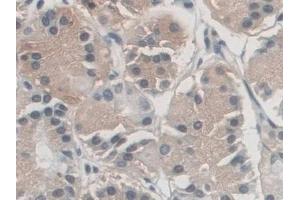 Detection of AZIN1 in Human Stomach Tissue using Polyclonal Antibody to Antizyme Inhibitor 1 (AZIN1) (Antizyme Inhibitor 1 antibody  (AA 5-290))