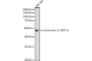 Western blot analysis of extracts of Rat eye, using Cytokeratin 12 (KRT12) (KRT12) antibody (ABIN7268087) at 1:500 dilution. (KRT12 antibody)