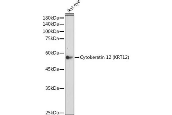 KRT12 anticorps