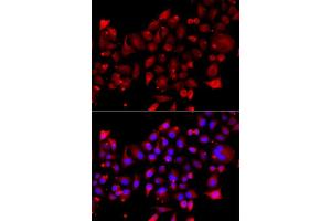 Immunofluorescence analysis of A549 cells using RRM2B antibody (ABIN5974964).