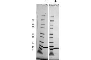 SDS-PAGE of Human ITAC (CXCL11) Recombinant Protein SDS-PAGE of Human ITAC (CXCL11) Recombinant Protein. (CXCL11 Protein)