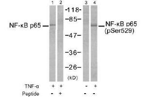 Image no. 2 for anti-Nuclear Factor-kB p65 (NFkBP65) (pSer529) antibody (ABIN196955) (NF-kB p65 antibody  (pSer529))