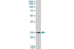 NQO2 polyclonal antibody (A01), Lot # DOH0051214QCS1 Western Blot analysis of NQO2 expression in HeLa . (NQO2 antibody  (AA 1-231))