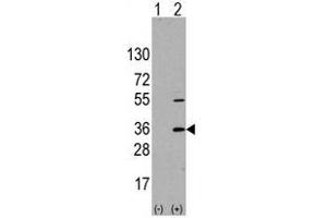 Image no. 1 for anti-Signal Sequence Receptor, alpha (SSR1) (N-Term) antibody (ABIN356936) (SSR1 antibody  (N-Term))