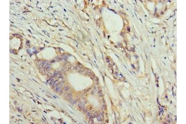 TET1 antibody  (AA 1700-1800)