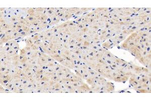 Detection of NUP85 in Human Cardiac Muscle Tissue using Polyclonal Antibody to Nucleoporin 85 (NUP85) (NUP85 antibody  (AA 130-368))