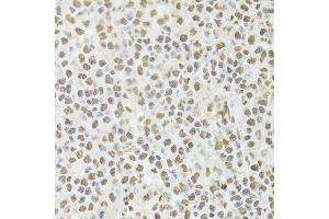 Immunohistochemistry (Paraffin-embedded Sections) (IHC (p)) image for anti-Acidic (Leucine-Rich) Nuclear phosphoprotein 32 Family, Member A (ANP32A) (AA 1-170) antibody (ABIN6136909)