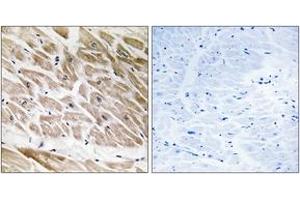 Immunohistochemistry analysis of paraffin-embedded human heart tissue, using RHG1 Antibody. (RHG1 (AA 189-238) antibody)