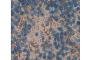 Used in DAB staining on fromalin fixed paraffin- embedded Kidney tissue (EMR2 antibody  (AA 347-509))
