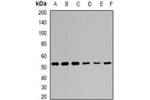 Western blot analysis of KLF4 expression in Hela (A), BT474 (B), NIH3T3 (C), mouse brain (D), mouse spleen (E), rat testis (F) whole cell lysates. (KLF4 antibody)